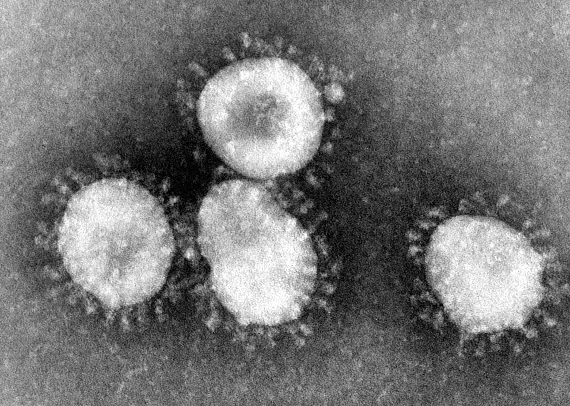 Coronavirus and food safety